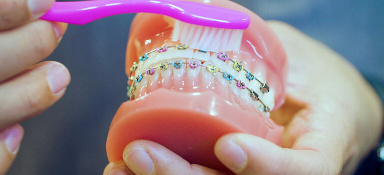 Orthodontist In Deland Fl